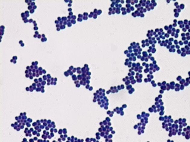 Gram stain -VE Pink/red +VE Purple/blue Bacilli Cocci Bacilli Cocci Catalase test +VE Bubbles -VE No reaction Streptococcus Staphylococcus In