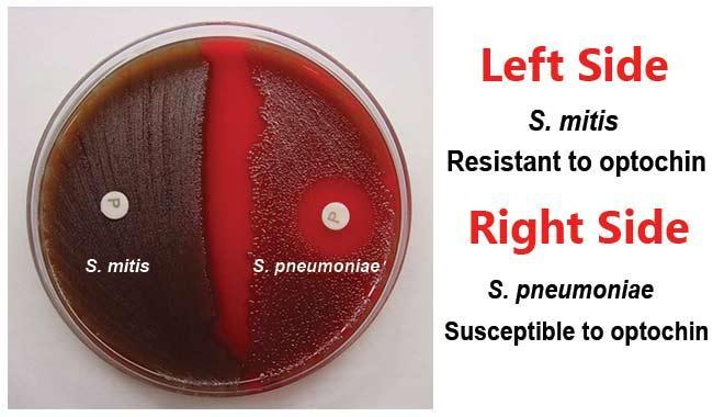known as streptococcus pyogenes) Sensitive * sensitive when the zone of growth inhibited.