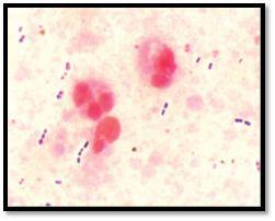 (arranged in pairs) Negative Stains showing