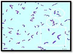 Diphtheria pharyngitis Bacterial: Corynebacterium diphtheriae, Group A streptococci.