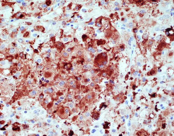 7Immunohistochemical stain for smooth