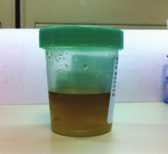 Figure 1. Secure clean container with lid for routine urinalysis. Today s Technician Samples can be obtained via normal voiding or by manual compression of the urinary bladder.