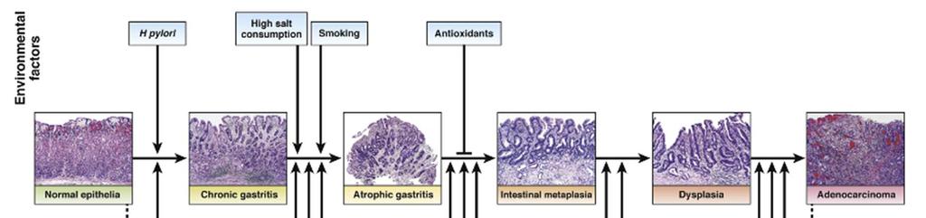 Pathogenesis of gastric cancer H.