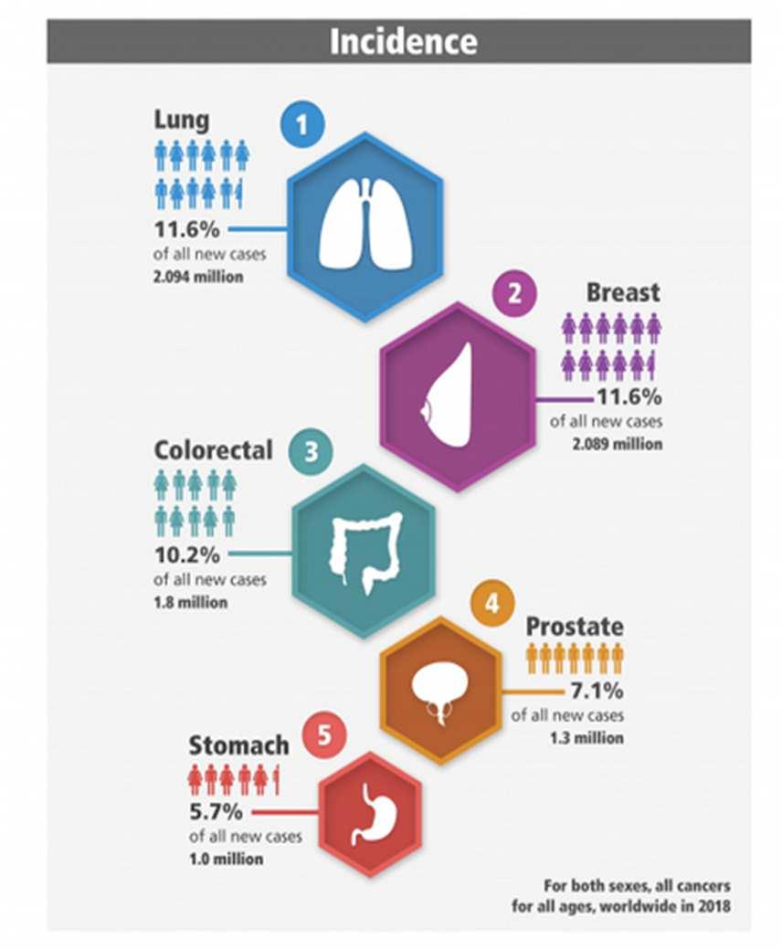 Gastric Cancer in 2018: Global Incidence 5 th most common cancer 1