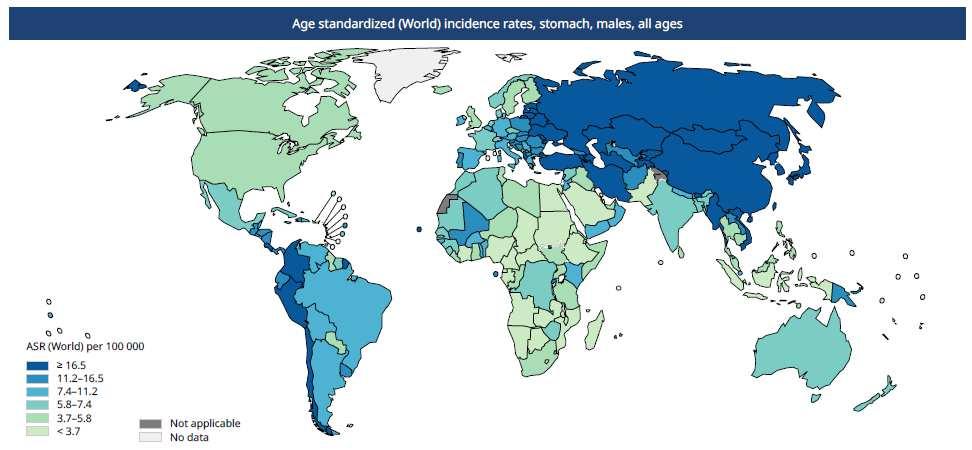 Gastric Cancer in 2018: Global Incidence Highest incidence in: Eastern Asia eg.