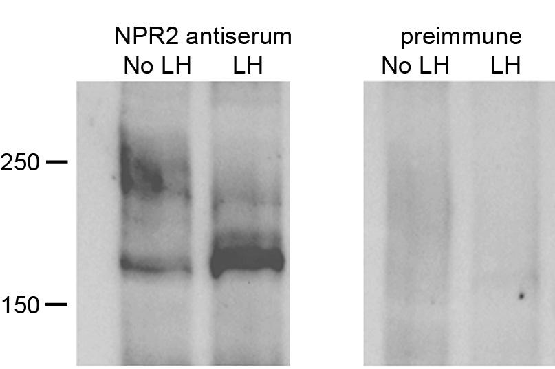 Figure S1. Validation of the specificity of the NPR2 antibody.