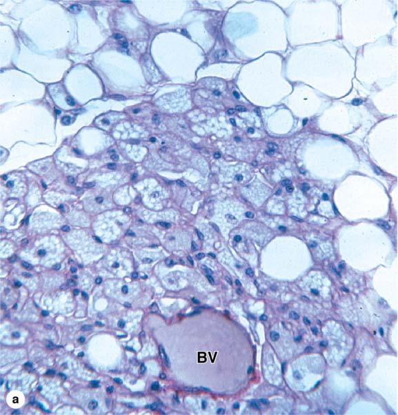 BROWN ADIPOSE TISSUE Color: due to numerous mitochondria (colored cytochromes) large number of blood capillaries Contain many small lipid inclusions Called multilocular Principal