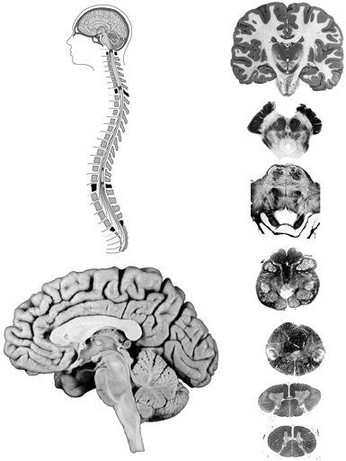 Note the The different regions of the brain from the lateral (side) and median section (middle) human brain.