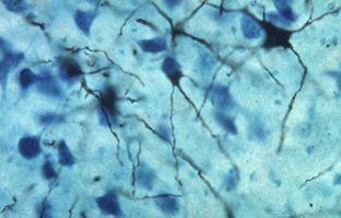 Photograph of neurons stained by Golgi s method which fills