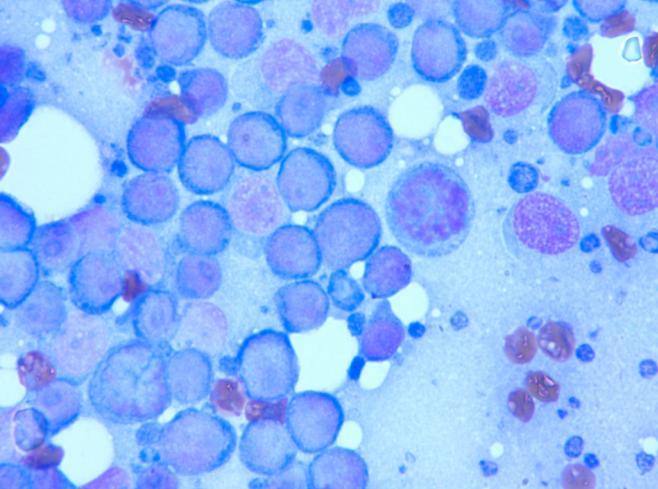 In higher grade lymphomas, finding a neutrophil in the smear is helpful as a size comparison.