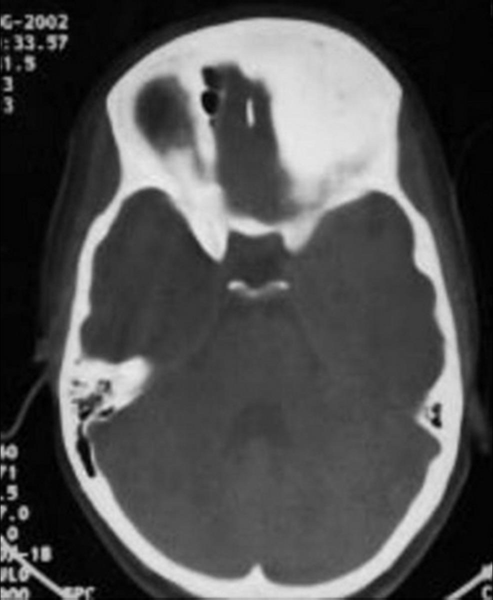 Fig. 11 Radiology, Farhat