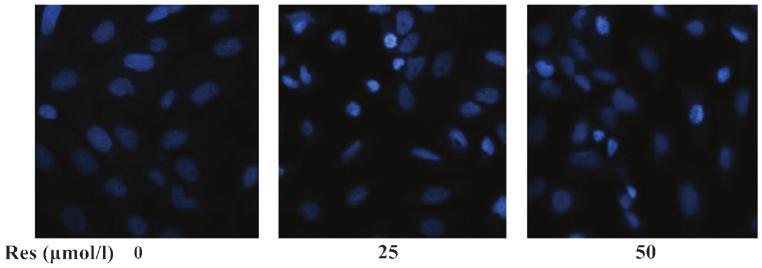 Apoptosis was detected via Hoechst 33258 staining and representative images are shown. Res, resveratrol. Figure 4.