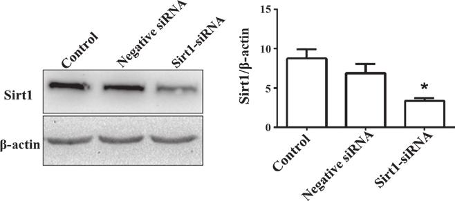 2688 JIN et al: RESVERATROL INHIBITS CHONDROSARCOMA CELLS VIA SIRT1 AND STAT3 Figure 5. Res reduces the expression of p STAT3 in SW1353 cells.
