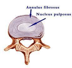 Osteology cont Intervertebral Disks cont: Annulus