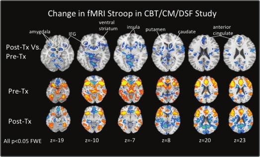Treatment-Related Changes in Neural Correlates