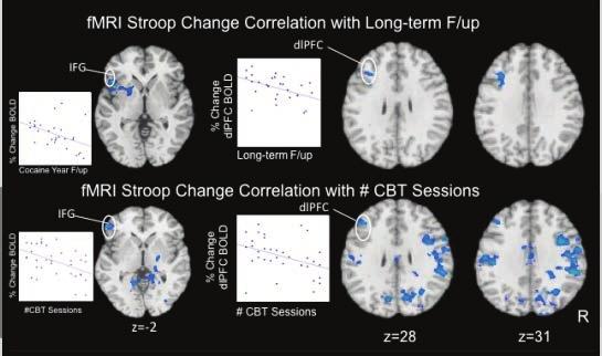 Changes in Neural Correlates of Cognitive Control