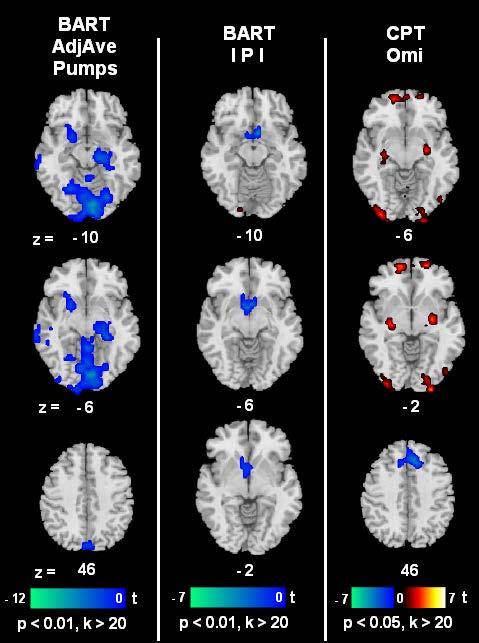 fmri Stroop in Adolescent Smokers: