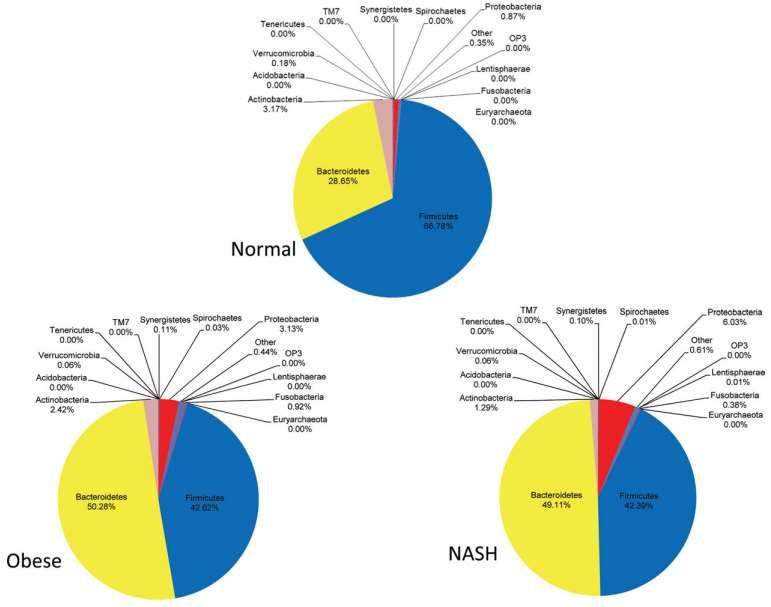 Gut Dysbiosis in NAFLD/NASH
