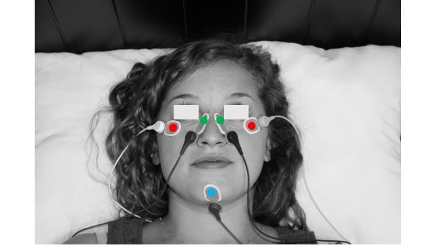 blue circle = recording area of ground electrode. Figure 2: nose reference electrode configuration.