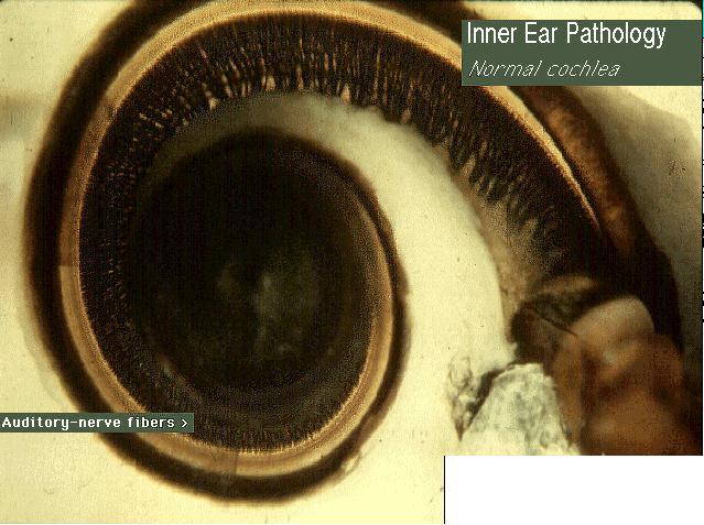 Cochlea The cilia (