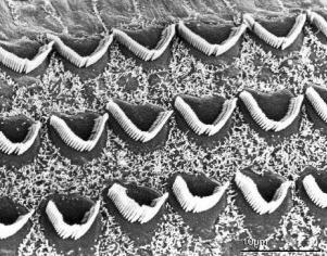 base of cochlea Low