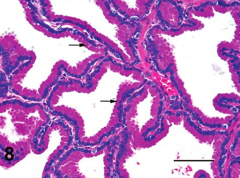 Mature prostatic epithelium characterized by a columnar epithelium with basal nuclei, an abundant eosinophilic apical cytoplasm, forming infoldings into alveolar lumen. Bar = 50 µm.