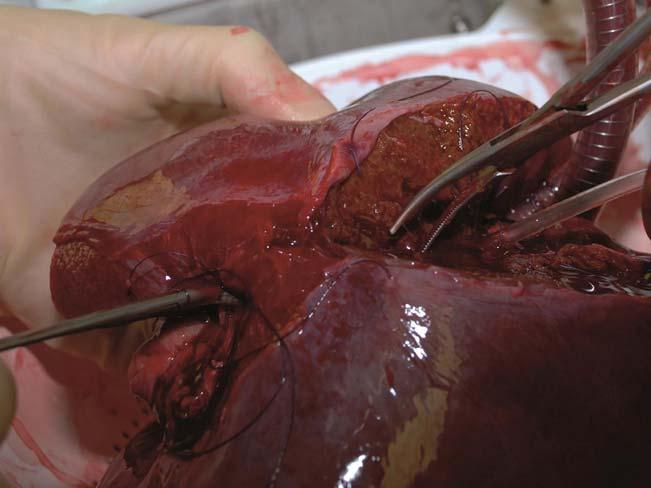 Cannulae from left to right: IVC outflow, portal vein inflow, hepatic artery inflow, and bile collection tube (empty). transected using scissors.