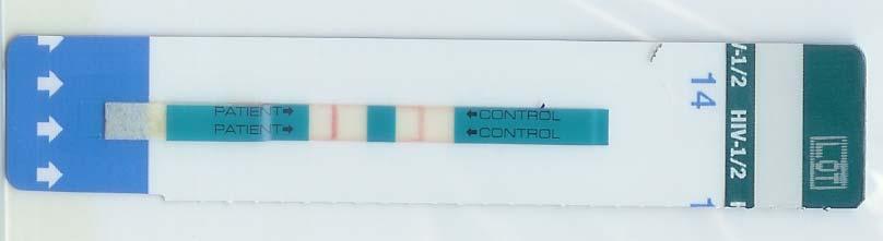 proviral DNA PCR not detected