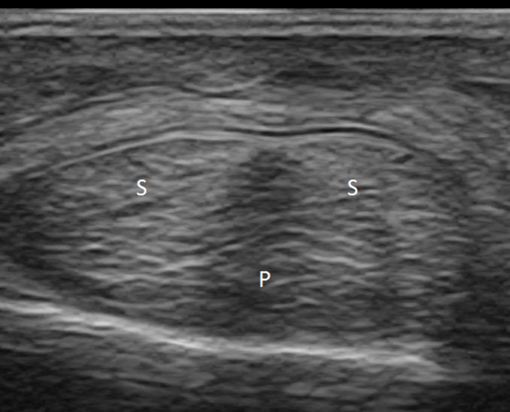 Fig. 4: Axial scan of the