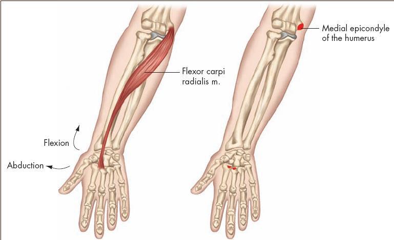 Individual Muscles of the Wrist and