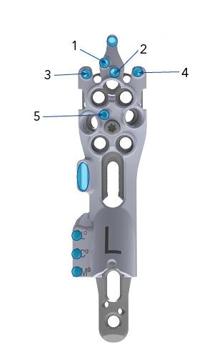 Position Wire D. Provisionally Fix Plate 1. Insert 2.0mm K-Wires to provisionally stabilize the reduced fracture and hold the plate to the bone. 2. Use a 2.