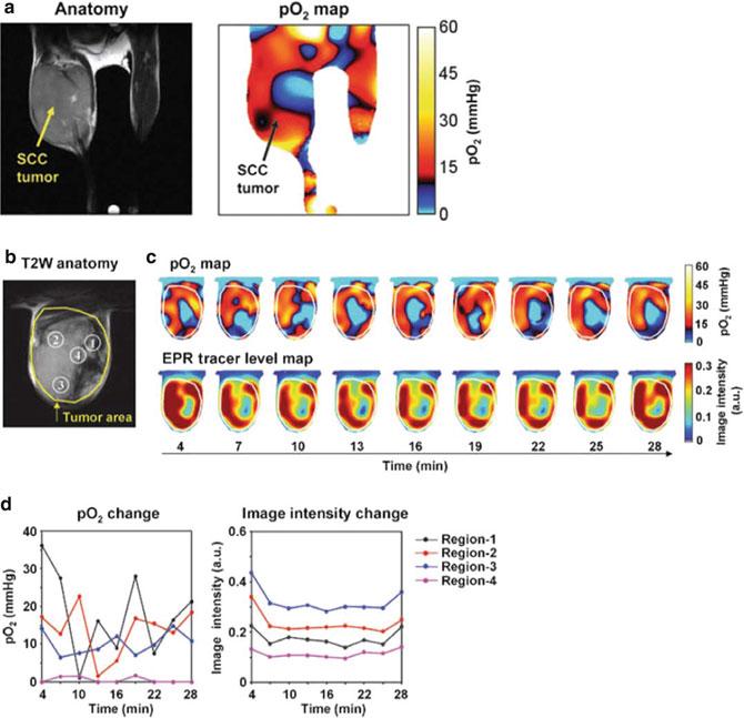 124 S. Naz et al. Fig. 5.7 Representative EPRI oxygen image monitoring temporal and spatial dynamics of cycling and chronic hypoxia. ( a ) An EPR oxygen imaging of tumor-bearing mice.