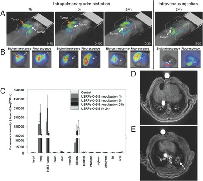 258 A. Al Zaki et al. Fig. 10.5 In vivo imaging of H358-Luc orthotopic lung tumor imaging. ( a ) Fluorescence imaging of USRPs-CY5.5. ( b ) Bioluminescence and fluorescence showing the colocalization between H358-Luc tumors and fluorescent USRPs.