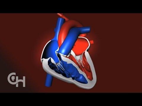 Ventricle Contraction Ventricles contraction