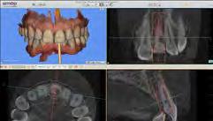 The patient s periodontal situation was healthy.