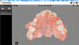 This powerful integration between the CS 3600 acquisition software and the patient s imaging chart eliminates the need for the practice to acquire traditional 2D orthodontic intraoral photographic