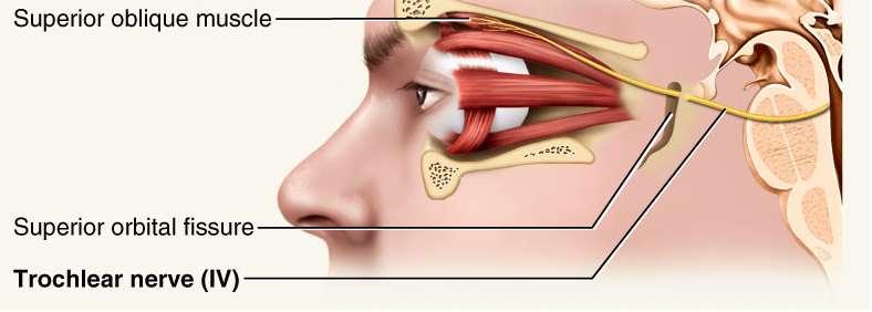 Trochlear Nerve IV Eye movement (superior oblique muscle) Damage
