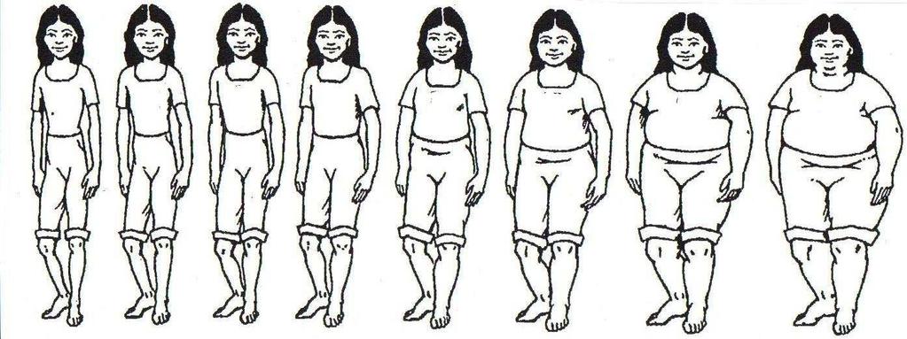 Findings Body Satisfaction "What do you think of your body size?" More normal weight than obese children felt that their body size was just right.