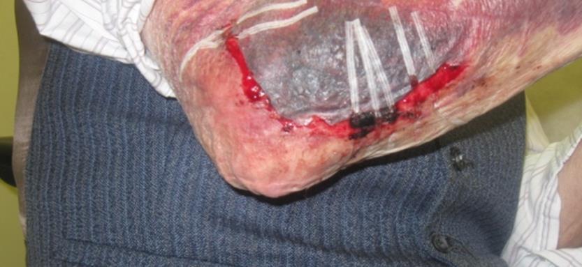 t heal Use grading tools Hints & tips: Wound