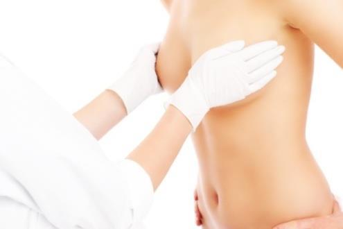 (trans-umbilical breast augmentation) or Periumbilical Site of incision