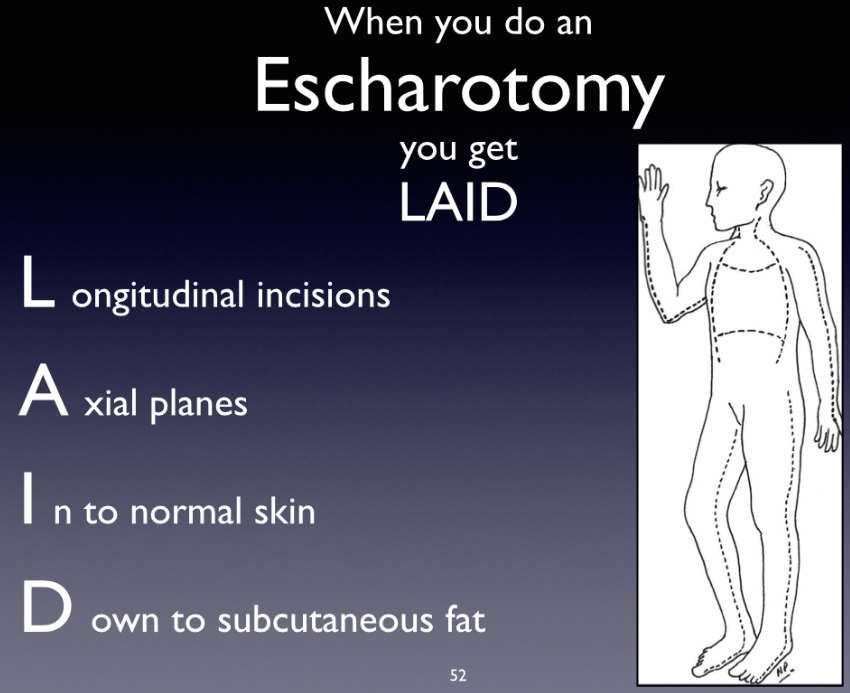 Escharotomy Escharotomy NOT fasciotomy