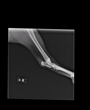 Fig 4 Xray of a strained gastrocnemius. Note the swollen lower end of tendon where it inserts into the calcaneus.