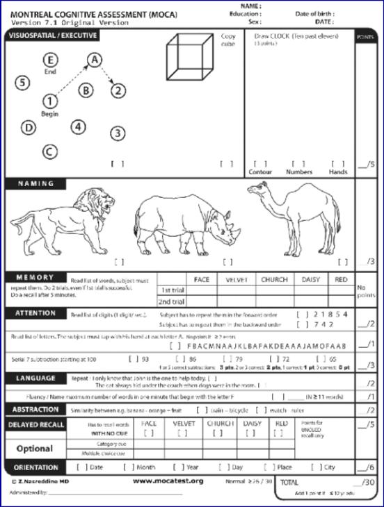 Montreal Cognitive Assessment (MoCA) Strengths Brief (10-12 min) Easy to administer/score Captures executive functioning More accurate than MMSE for MCI No