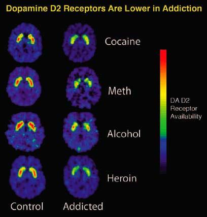 the likelihood that an individual will develop addiction. Environmental factors interact with the person s biology and affect the extent to which genetic factors exert their influence.