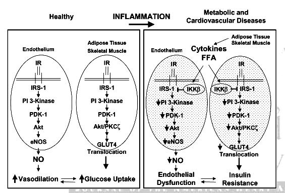 Cross-talk between inflammatory and insulin signaling pathways causes both endo.