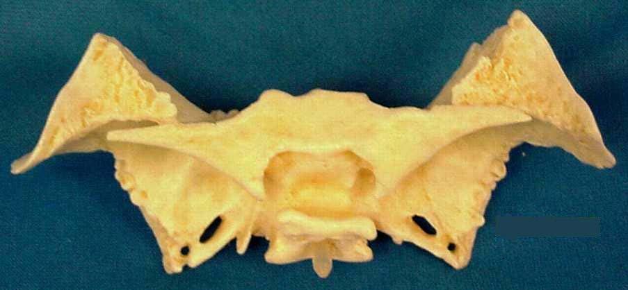 Sphenoid Bone, Superior View (with parts visible from inside skull with skullcap removed) Lesser wing Anterior