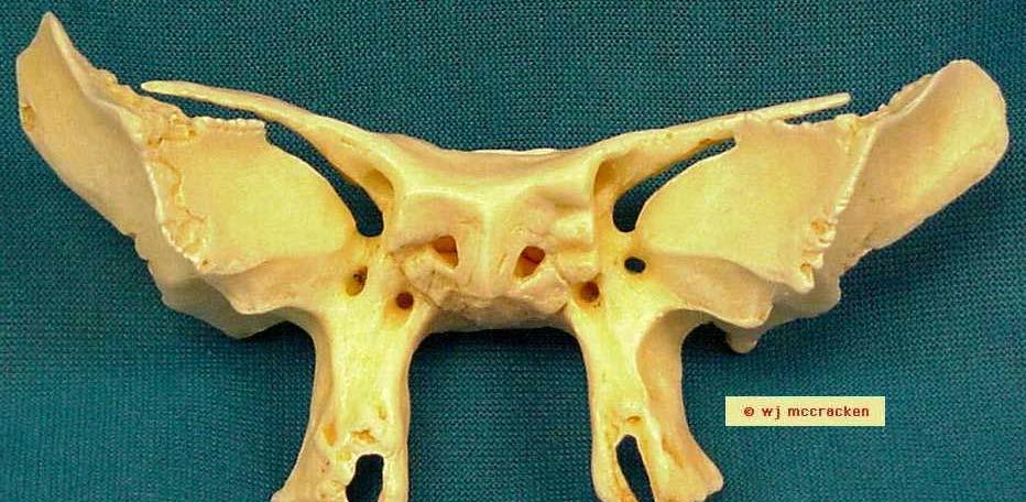 Sphenoid Bone, Anterior View Greater wings Superior orbital fissure Lesser wings Sphenoidal sinuses Pterygoid fossa