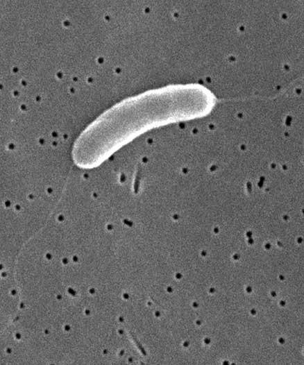 Bacteria Bacteria are one-celled microorganisms that are classified by shape.