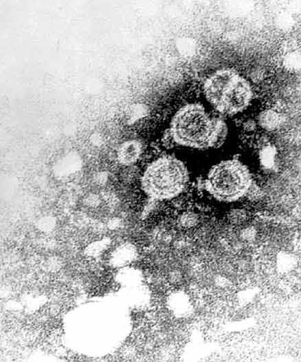 Viruses Viruses are the smallest type of microorganism. They are made up of only a few molecules.