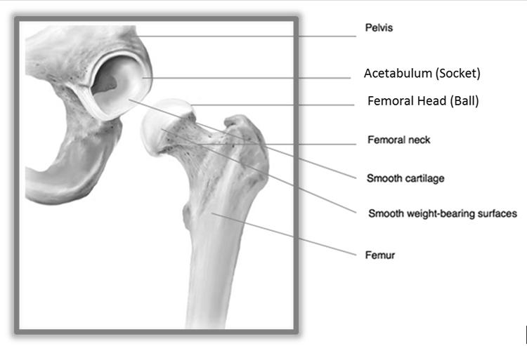 Figure 2. What is the R3 delta Ceramic Acetabular System? The R3 delta Ceramic Acetabular System (see diagram, Figure 3) is used for total hip replacements.